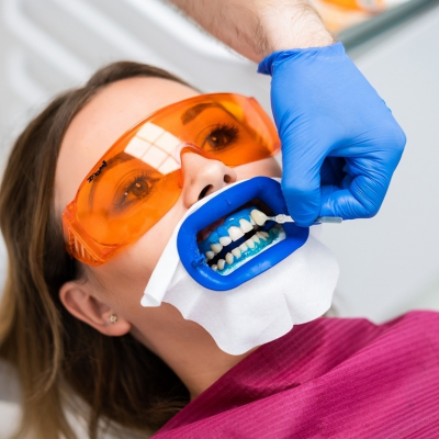 Teeth whitening: the price of a service in Barcelona